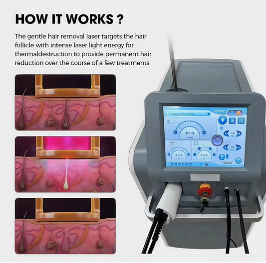 2026 SLyriclaser 1064/532nm long pulse width High quality 1064nm painless hair removal Clinic 755NM alexandrite machine