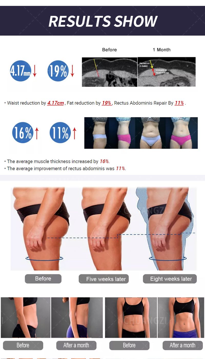 EMS Body Sculpt 6500w EMS Body Slimming Fat Burning Muscle Sculpting Electromagnetic Stimulate Sculpt Therapy Machine