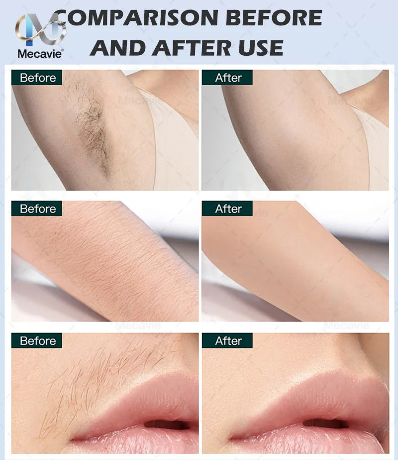 Newest 2 in 1 Multifunction Epilation Diode Laser Hair Removal Machine Pico laser Nd Yag tattoo removal machine Carbon Peeling