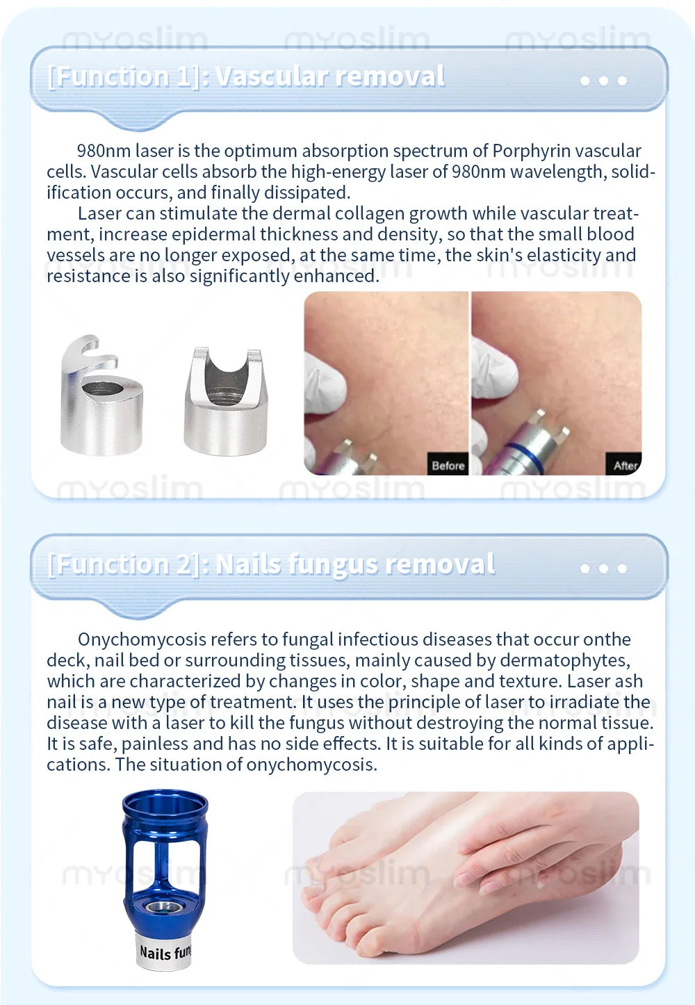 BEST 30W 5 in 1 980nm Diode Laser Vascular Removal Machine Remove Spider Veins 980 Diode Laser Blood Vessels Removal Nail Fungus