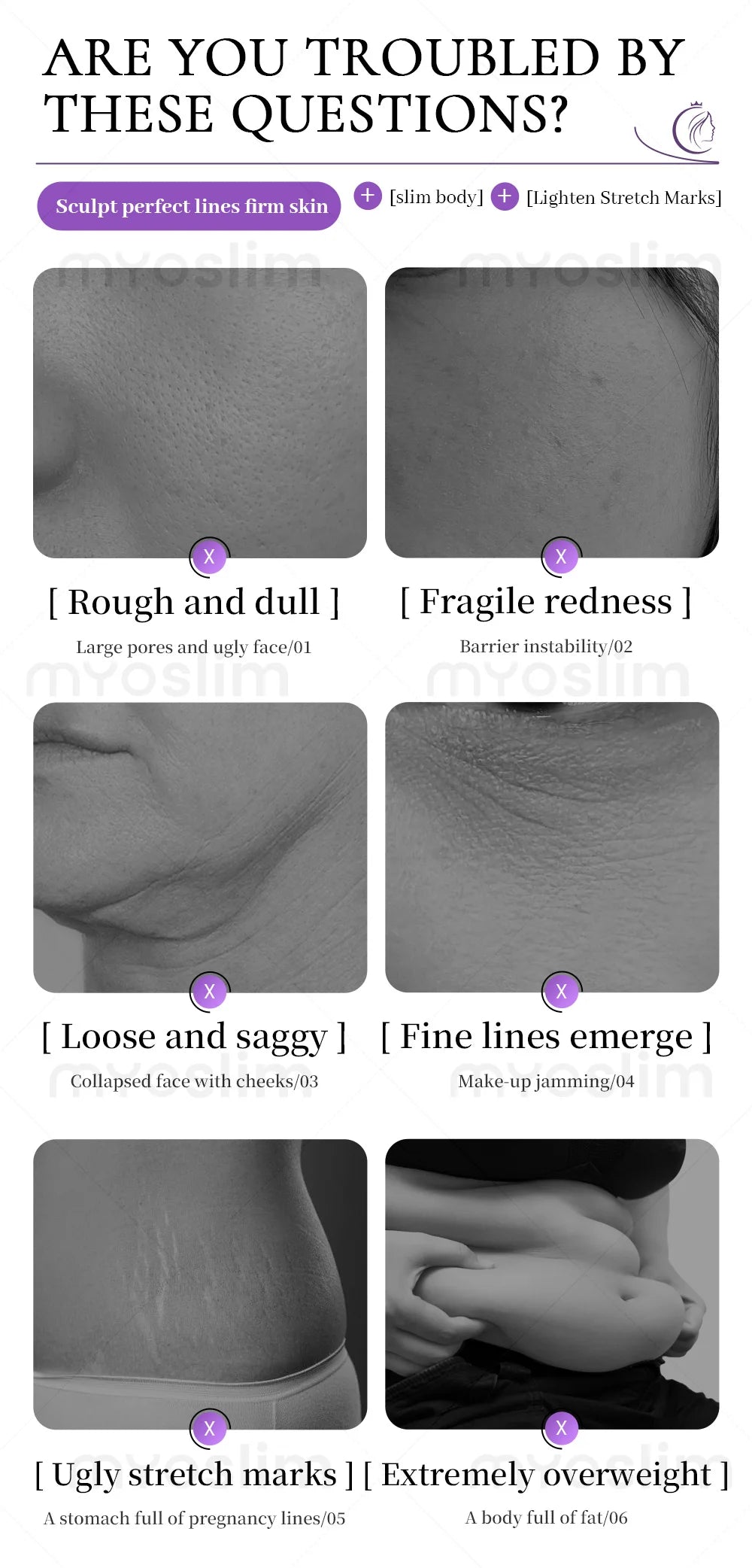 Actimel Venus Legacy Equipment Skin Tightening Vacuum Slimming cellulite Removal Vacuum Legacy Skin Lifting SPA Device For Salon