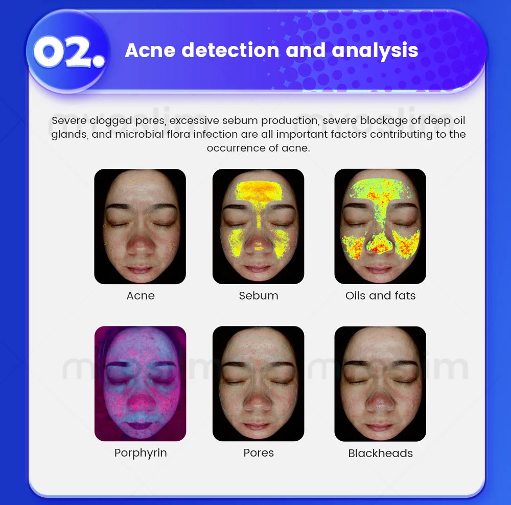 X5 3D Ai Skin Image Analyzer 21.5 inch High Definition Pixels Whole Facial Scanning Multi Spectrum Moisture Scalp Detection CE