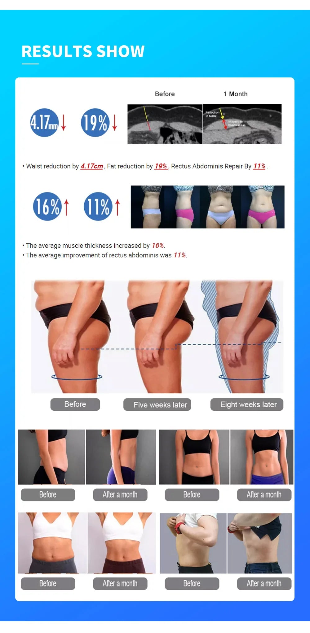 Myoslim Roller Slimming 360Degree Rolling Cellulite Massage Weights Loss Machine Body Muscle body slimming fat removal