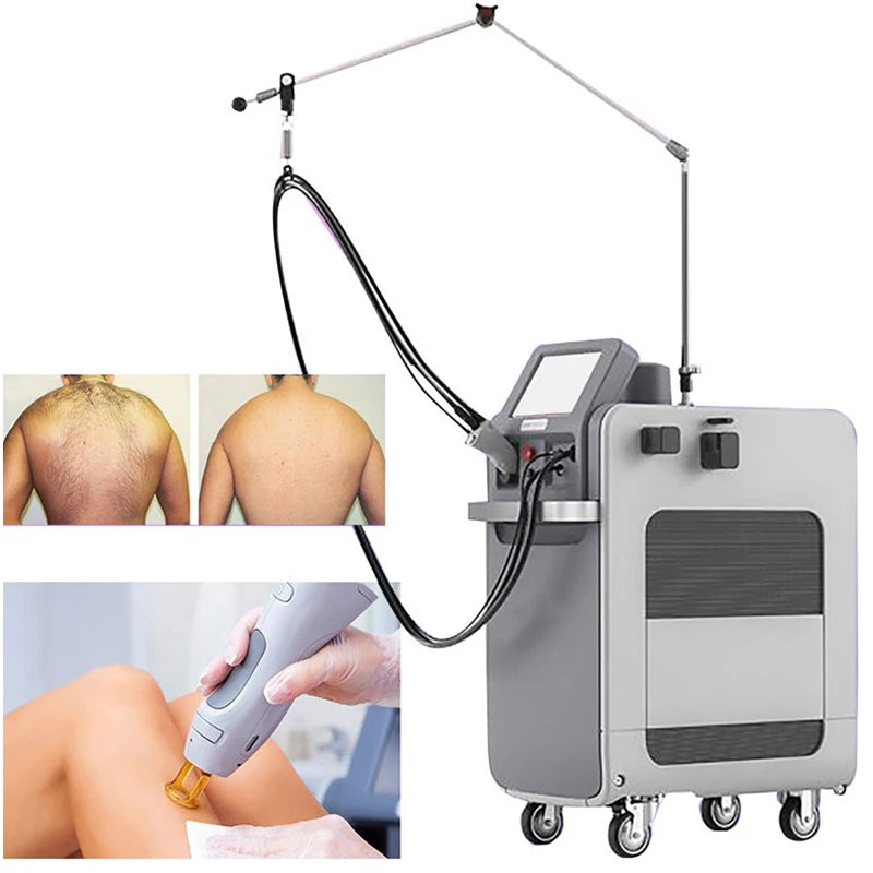 2026 SLyriclaser 1064/532nm long pulse width High quality 1064nm painless hair removal Clinic 755NM alexandrite machine