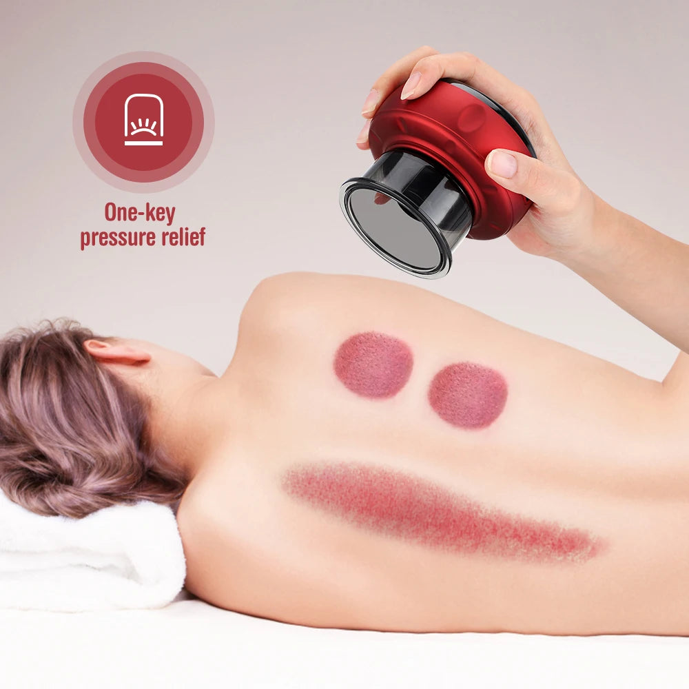 Smart Cupping Vacuum Massage Jars Heating Suction Cup Cellulite Medical Chinese Electric Cupping Therapy Body Relax Guasha Cans