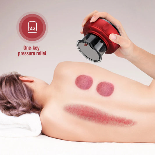 Smart Cupping Vacuum Massage Jars Heating Suction Cup Cellulite Medical Chinese Electric Cupping Therapy Body Relax Guasha Cans
