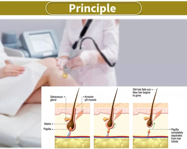 Professional Painless Hair Removal Clinic 808NM Alexandrite Machine